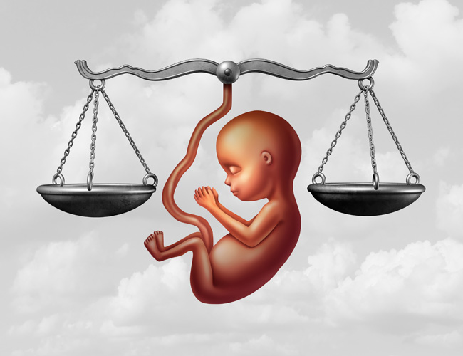 שינוי חוק הוועדה להפסקת היריון